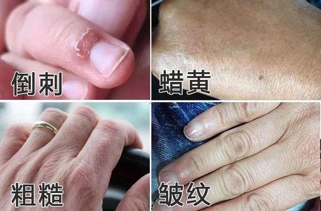 手霜！跪求你买这8支好用到想报警！J9真人游戏第一品牌冬日的第一支护(图3)
