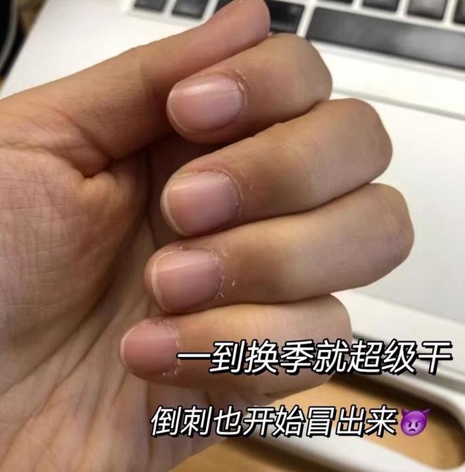 个牌子的好：护手霜哪个牌子美白保湿好J9数字平台2025氨基酸护手霜哪(图3)